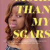 More Than My Scars